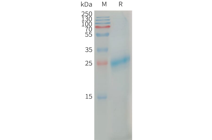 SDS-PAGE - Recombinant Human CLEC4C Protein (6×His Tag) (A317668) - Antibodies.com