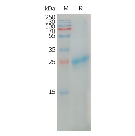 SDS-PAGE - Recombinant Human CLEC4C Protein (6×His Tag) (A317668) - Antibodies.com