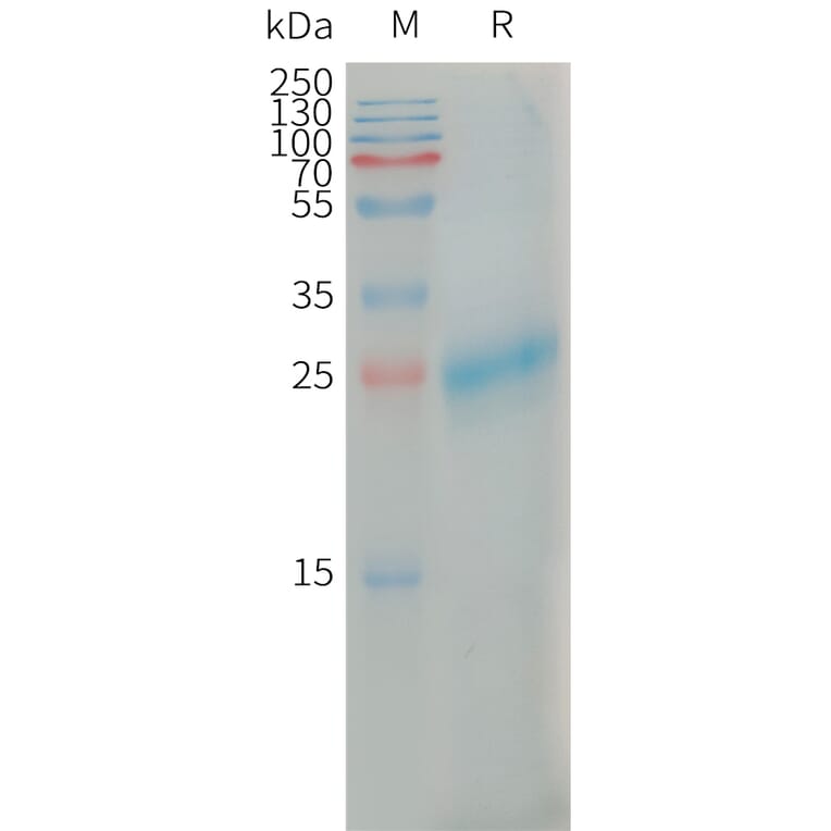 SDS-PAGE - Recombinant Human CLEC4C Protein (6×His Tag) (A317668) - Antibodies.com