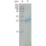 SDS-PAGE - Recombinant Human CLEC4C Protein (6×His Tag) (A317668) - Antibodies.com