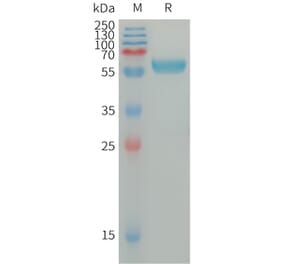 SDS-PAGE - Recombinant Human IGSF11 Protein (Fc Tag) (A317669) - Antibodies.com