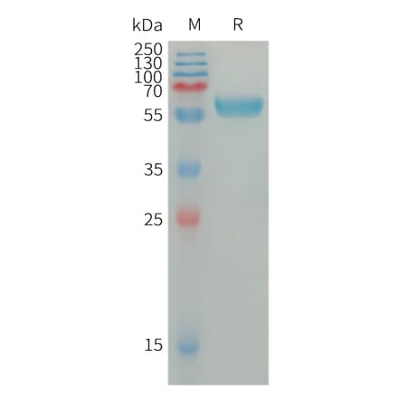 SDS-PAGE - Recombinant Human IGSF11 Protein (Fc Tag) (A317669) - Antibodies.com