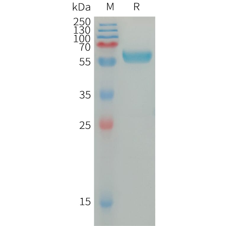 SDS-PAGE - Recombinant Human IGSF11 Protein (Fc Tag) (A317669) - Antibodies.com