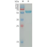 SDS-PAGE - Recombinant Human IGSF11 Protein (Fc Tag) (A317669) - Antibodies.com