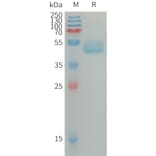 SDS-PAGE - Recombinant Human IL-4 Protein (Fc Tag) (A317670) - Antibodies.com