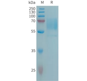 SDS-PAGE - Recombinant Human CD98 Protein (6×His Tag) (A317671) - Antibodies.com