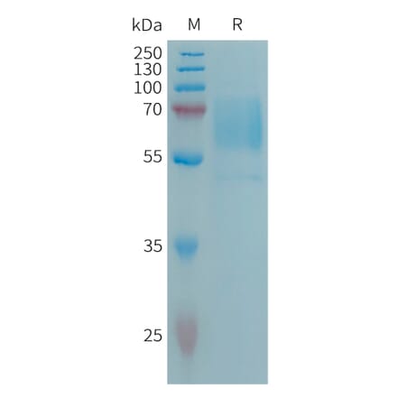 SDS-PAGE - Recombinant Human CD98 Protein (6×His Tag) (A317671) - Antibodies.com
