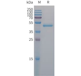 SDS-PAGE - Recombinant Human PAI1 Protein (6×His Tag) (A317673) - Antibodies.com
