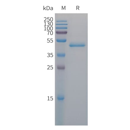 SDS-PAGE - Recombinant Human PAI1 Protein (6×His Tag) (A317673) - Antibodies.com