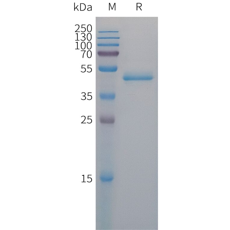 SDS-PAGE - Recombinant Human PAI1 Protein (6×His Tag) (A317673) - Antibodies.com