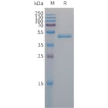 SDS-PAGE - Recombinant Human PAI1 Protein (6×His Tag) (A317673) - Antibodies.com