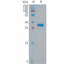 SDS-PAGE - Recombinant Human CDKN2A/p14ARF Protein (Fc Tag) (A317676) - Antibodies.com