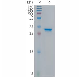 SDS-PAGE - Recombinant Human CDKN2A/p14ARF Protein (Fc Tag) (A317677) - Antibodies.com
