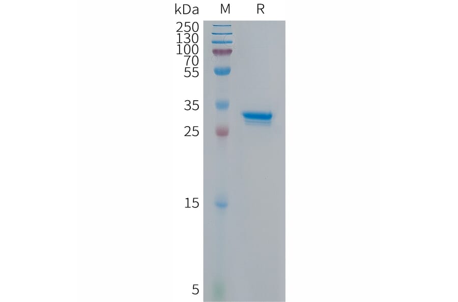 SDS-PAGE - Recombinant Human CDKN2A/p14ARF Protein (Fc Tag) (A317677) - Antibodies.com
