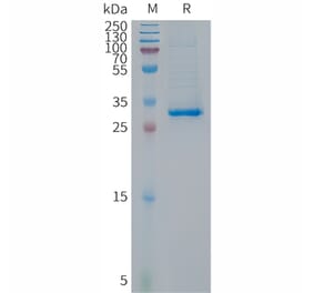 SDS-PAGE - Recombinant Human CDKN2A/p14ARF Protein (Fc Tag) (A317678) - Antibodies.com