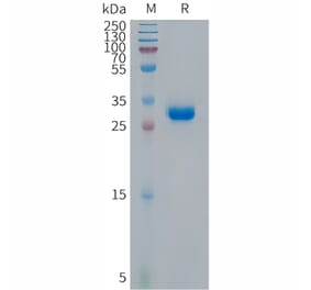 SDS-PAGE - Recombinant Human CDKN2A/p14ARF Protein (Fc Tag) (A317679) - Antibodies.com