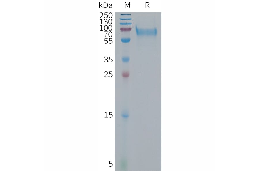 SDS-PAGE - Recombinant Human Bone Sialoprotein Protein (6×His Tag) (A317680) - Antibodies.com