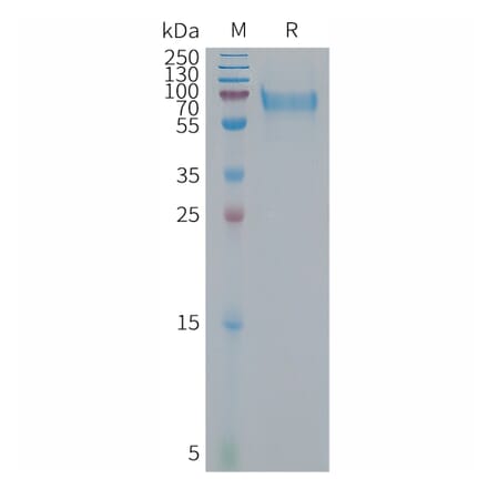 SDS-PAGE - Recombinant Human Bone Sialoprotein Protein (6×His Tag) (A317680) - Antibodies.com