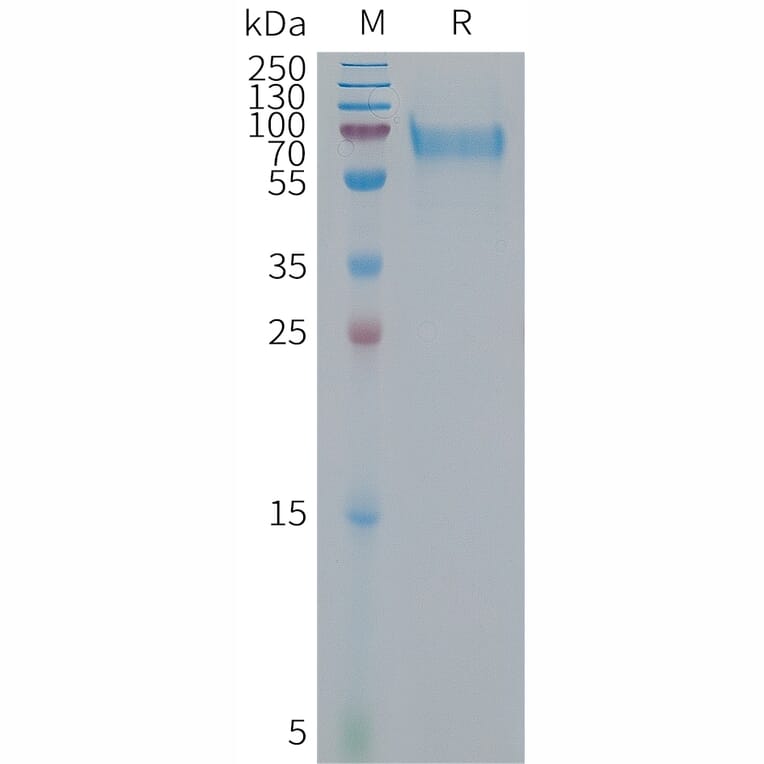 SDS-PAGE - Recombinant Human Bone Sialoprotein Protein (6×His Tag) (A317680) - Antibodies.com