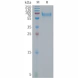 SDS-PAGE - Recombinant Human Bone Sialoprotein Protein (6×His Tag) (A317680) - Antibodies.com