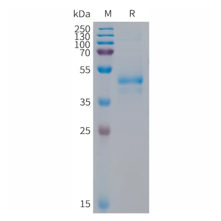 SDS-PAGE - Recombinant Human Artemin Protein (Fc Tag) (A317682) - Antibodies.com