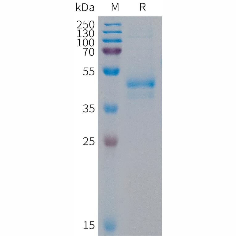 SDS-PAGE - Recombinant Human Artemin Protein (Fc Tag) (A317682) - Antibodies.com