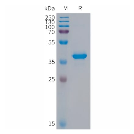 SDS-PAGE - Recombinant Human S100A9 Protein (Fc Tag) (A317683) - Antibodies.com