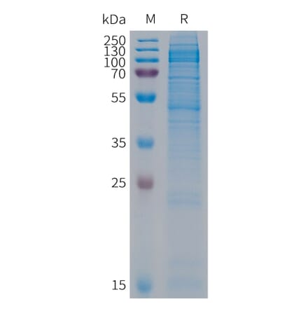 SDS-PAGE - Recombinant Human CDH19 Protein (6×His Tag) (A317684) - Antibodies.com