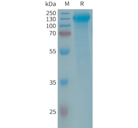 SDS-PAGE - Recombinant Human GPCR GPR64 Protein (6×His Tag) (A317685) - Antibodies.com