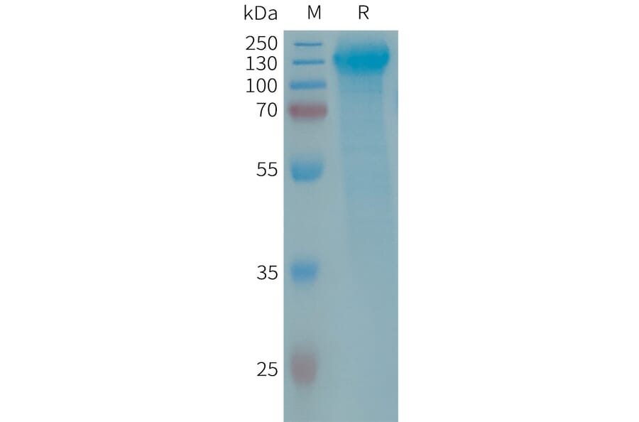 SDS-PAGE - Recombinant Human GPCR GPR64 Protein (6×His Tag) (A317685) - Antibodies.com