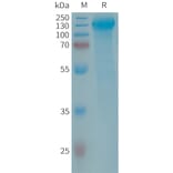 SDS-PAGE - Recombinant Human GPCR GPR64 Protein (6×His Tag) (A317685) - Antibodies.com