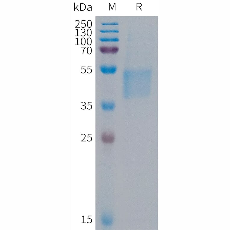 SDS-PAGE - Recombinant Human FSTL1/FRP Protein (6×His Tag) (A317686) - Antibodies.com