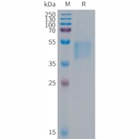 SDS-PAGE - Recombinant Human FSTL1/FRP Protein (6×His Tag) (A317686) - Antibodies.com