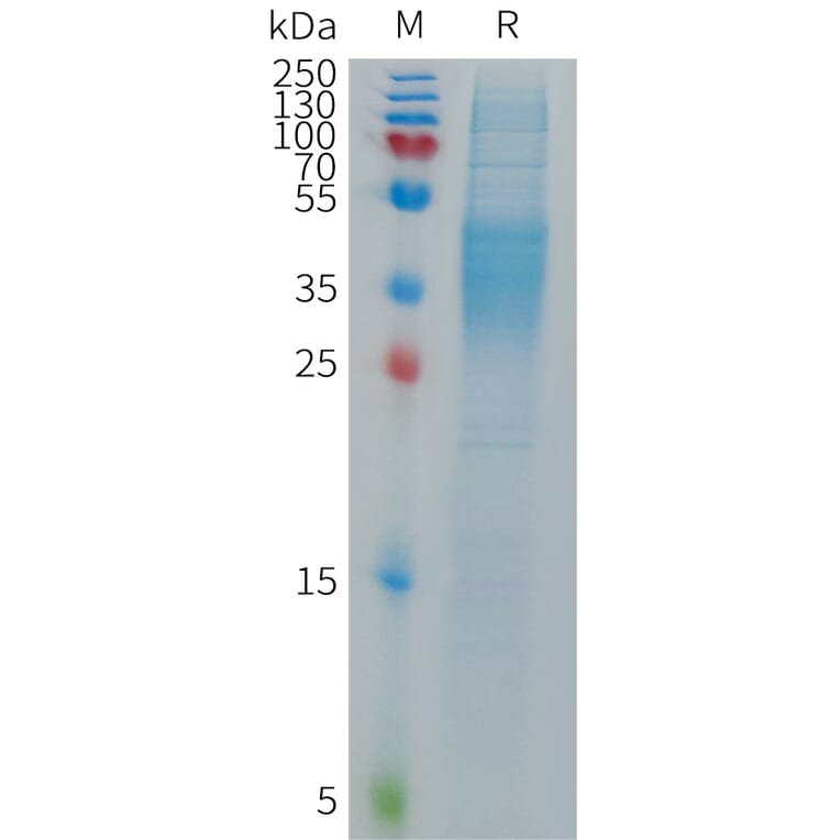 SDS-PAGE - Recombinant Human CD16b Protein (6×His Tag) (A317687) - Antibodies.com