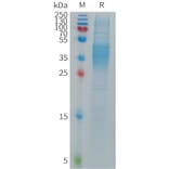 SDS-PAGE - Recombinant Human CD16b Protein (6×His Tag) (A317687) - Antibodies.com