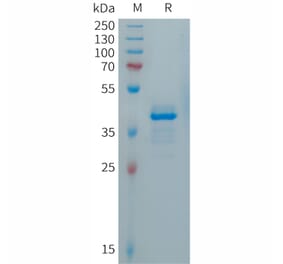 SDS-PAGE - Recombinant Human Calcitonin Protein (Fc Tag) (A317688) - Antibodies.com