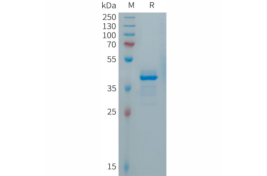 SDS-PAGE - Recombinant Human Calcitonin Protein (Fc Tag) (A317688) - Antibodies.com