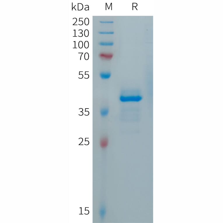 SDS-PAGE - Recombinant Human Calcitonin Protein (Fc Tag) (A317688) - Antibodies.com