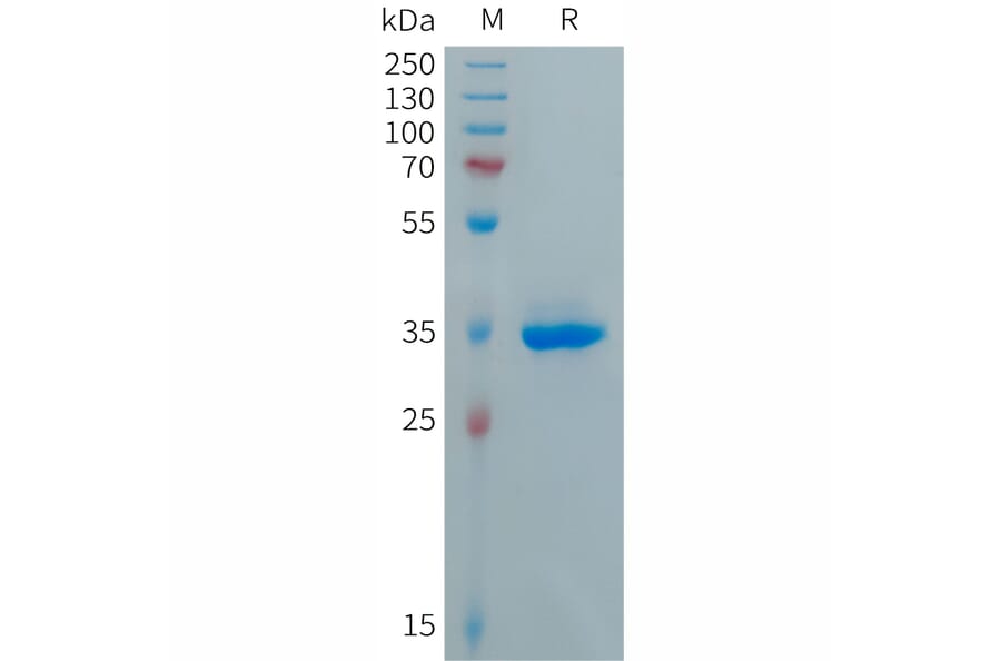 SDS-PAGE - Recombinant Human CXCL5 Protein (Fc Tag) (A317689) - Antibodies.com