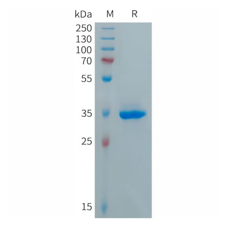 SDS-PAGE - Recombinant Human CXCL5 Protein (Fc Tag) (A317689) - Antibodies.com