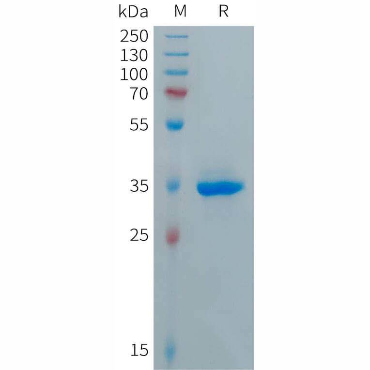 SDS-PAGE - Recombinant Human CXCL5 Protein (Fc Tag) (A317689) - Antibodies.com