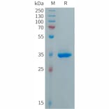 SDS-PAGE - Recombinant Human CXCL5 Protein (Fc Tag) (A317689) - Antibodies.com