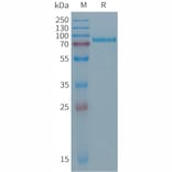 SDS-PAGE - Recombinant Human Desmoglein 2/DSG2 Protein (6×His Tag) (A317690) - Antibodies.com