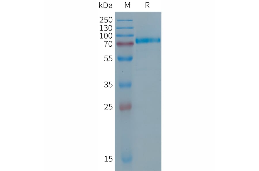 SDS-PAGE - Recombinant Human Desmoglein 2/DSG2 Protein (6×His Tag) (A317691) - Antibodies.com