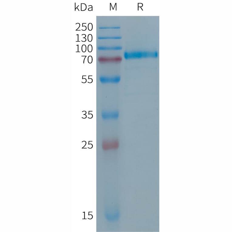 SDS-PAGE - Recombinant Human Desmoglein 2/DSG2 Protein (6×His Tag) (A317691) - Antibodies.com