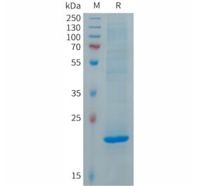 SDS-PAGE - Recombinant Human FGF19 Protein (6×His Tag) (A317692) - Antibodies.com