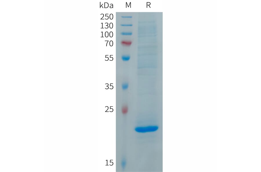 SDS-PAGE - Recombinant Human FGF19 Protein (6×His Tag) (A317692) - Antibodies.com