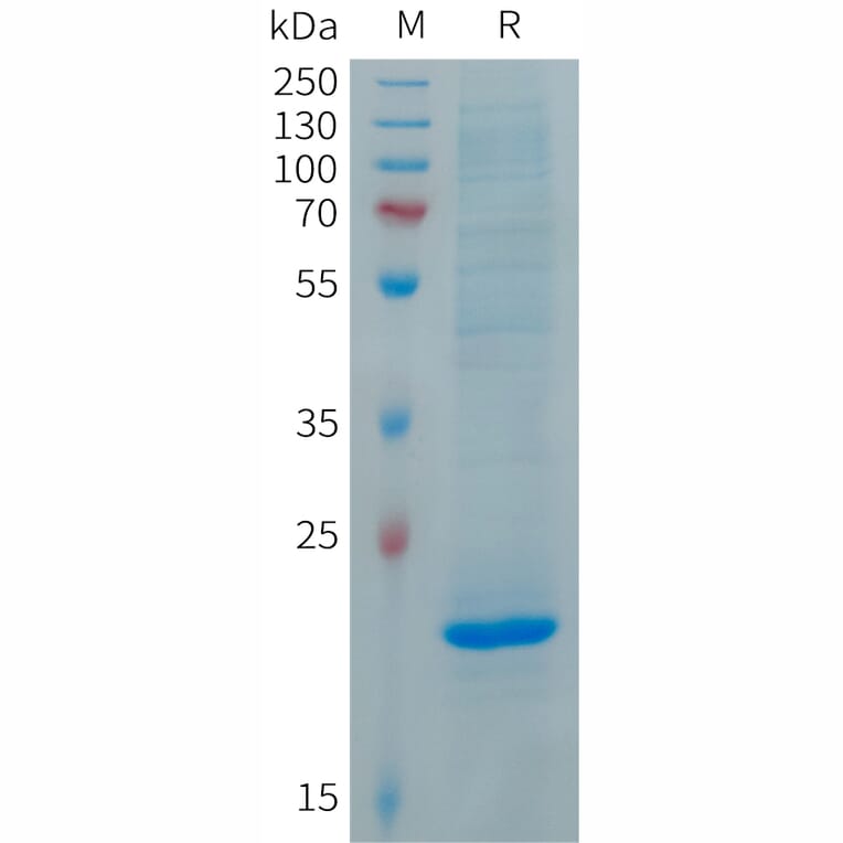 SDS-PAGE - Recombinant Human FGF19 Protein (6×His Tag) (A317692) - Antibodies.com