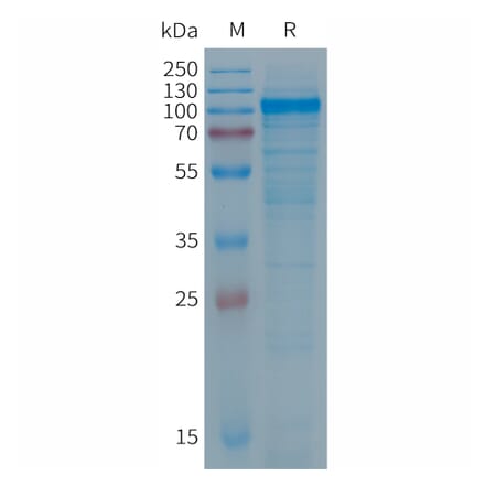 SDS-PAGE - Recombinant Human PTGFRN Protein (6×His Tag) (A317693) - Antibodies.com