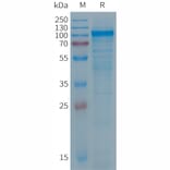 SDS-PAGE - Recombinant Human PTGFRN Protein (6×His Tag) (A317693) - Antibodies.com